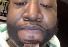 Ces artistes qui ont eu recours à une greffe de barbe Yung Joc